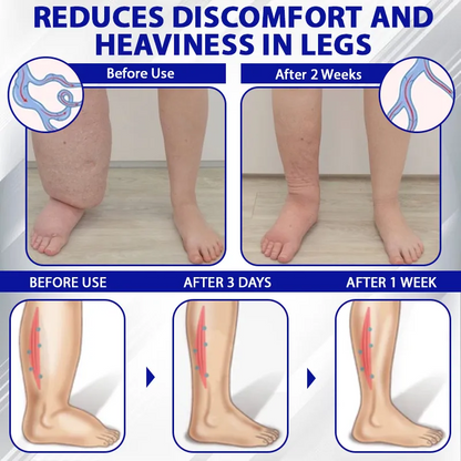 Tired, Swollen, or Heavy Legs? NESLEMY™ Restores Freedom of Movement!
