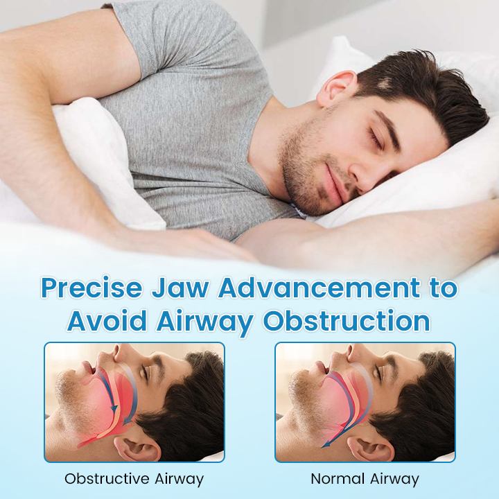 ✨QIAWI™ DreamGuard: Anti-Snoring & Teeth Grinding Mouthpiece